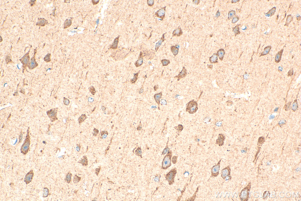 IHC staining of mouse brain using 29415-1-AP