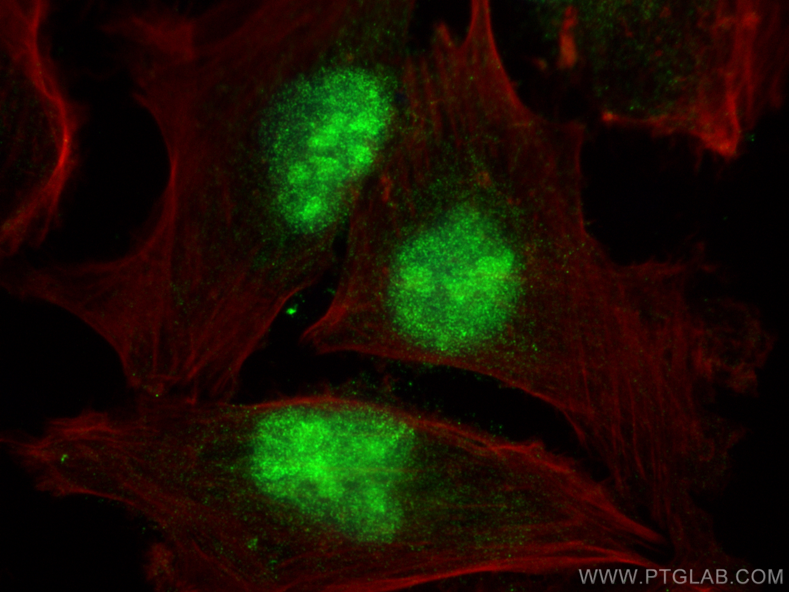 IF Staining of U-251 using 23786-1-AP