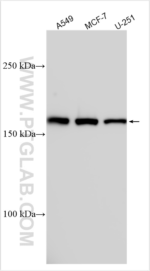 WB analysis using 23786-1-AP