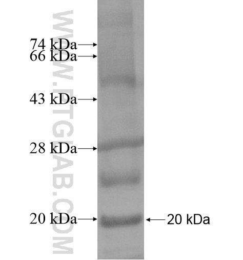 PTPRU fusion protein Ag15542 SDS-PAGE PTPRU fusion protein Ag15542 SDS-PAGE