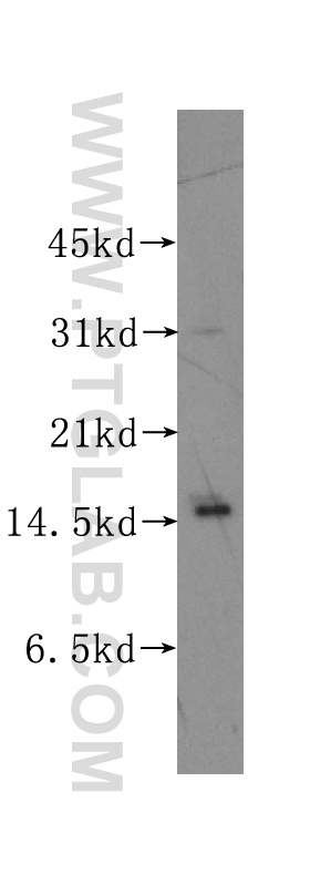 PTS Polyclonal antibody