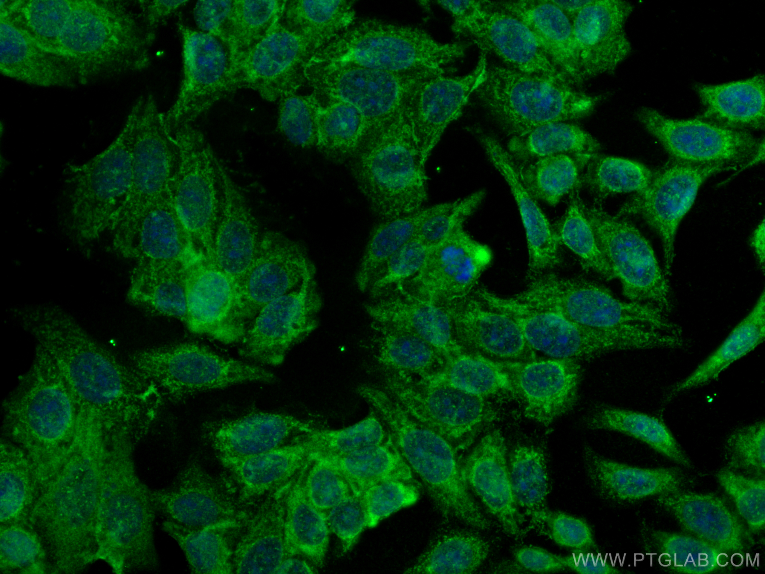 IF Staining of HepG2 using 18040-1-AP