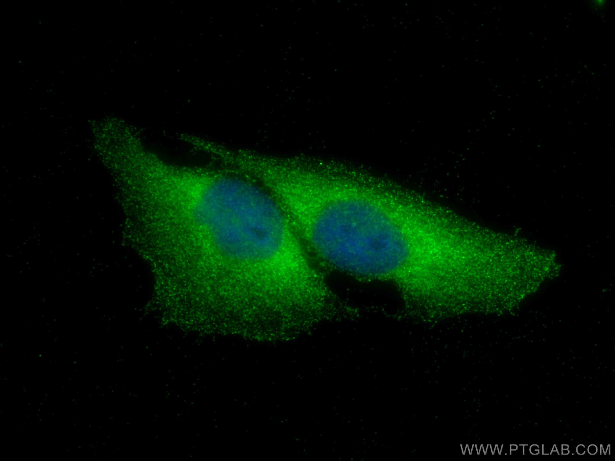 IF Staining of U2OS using 18040-1-AP