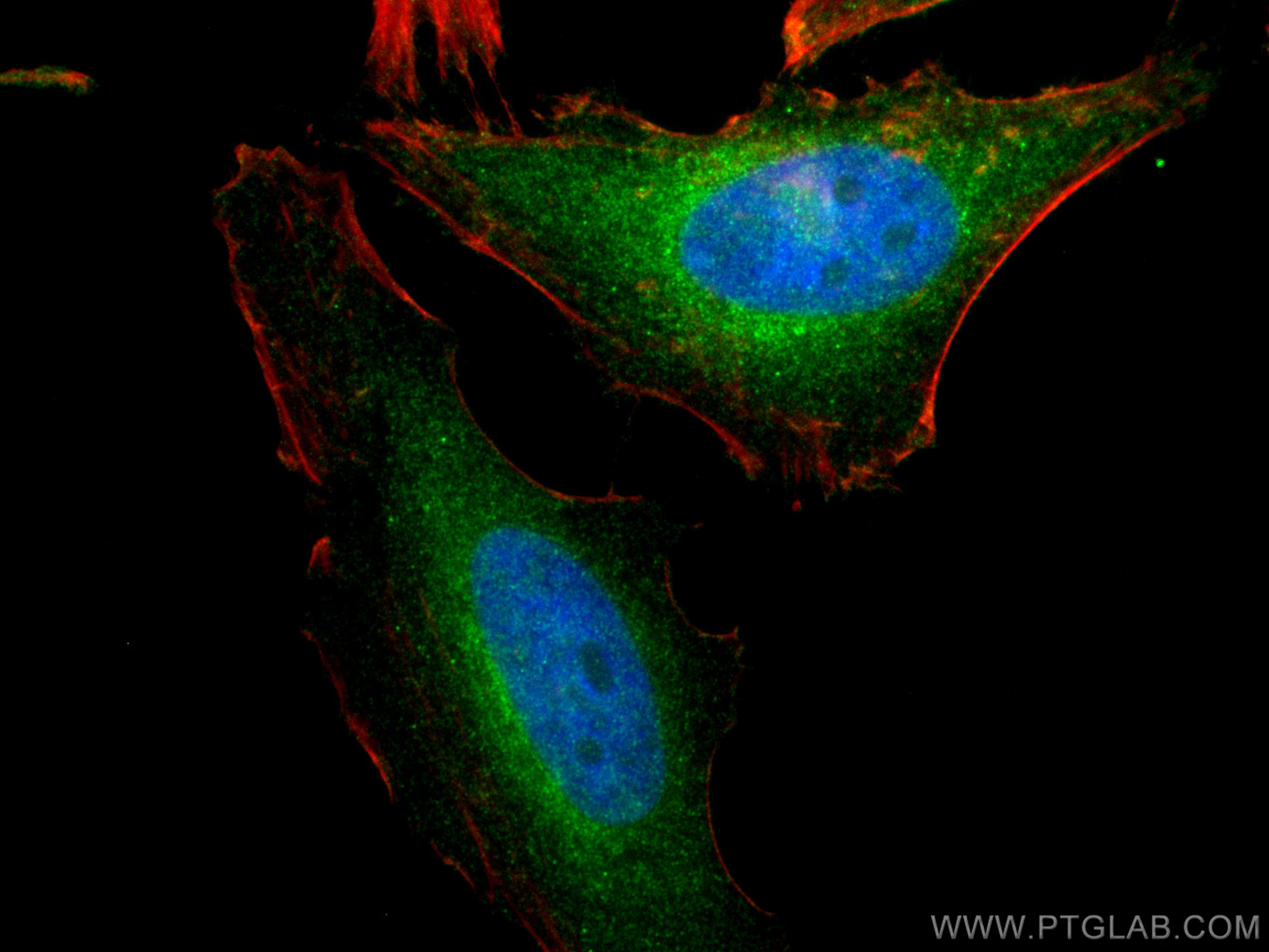 IF Staining of HeLa using 12575-1-AP (same clone as 12575-1-PBS)