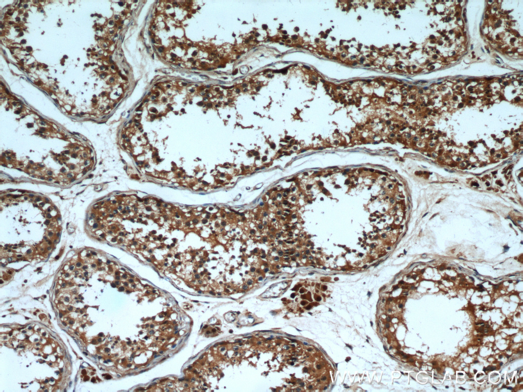 IHC staining of human testis using 12575-1-AP (same clone as 12575-1-PBS)
