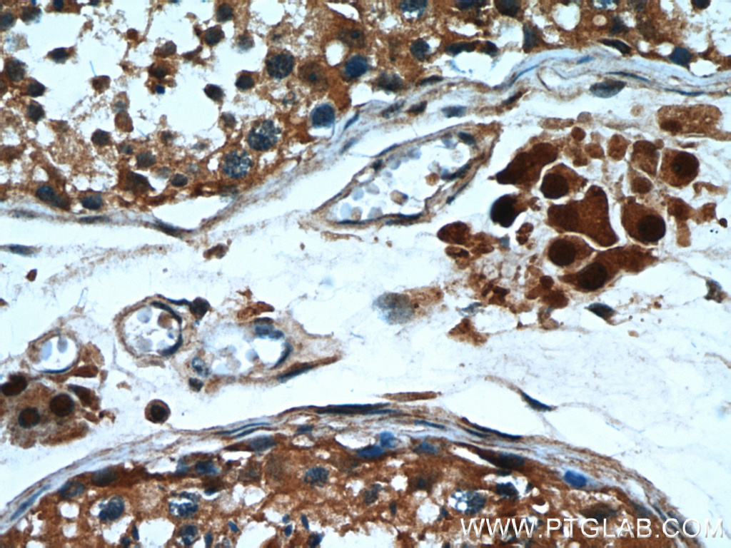IHC staining of human testis using 12575-1-AP (same clone as 12575-1-PBS)