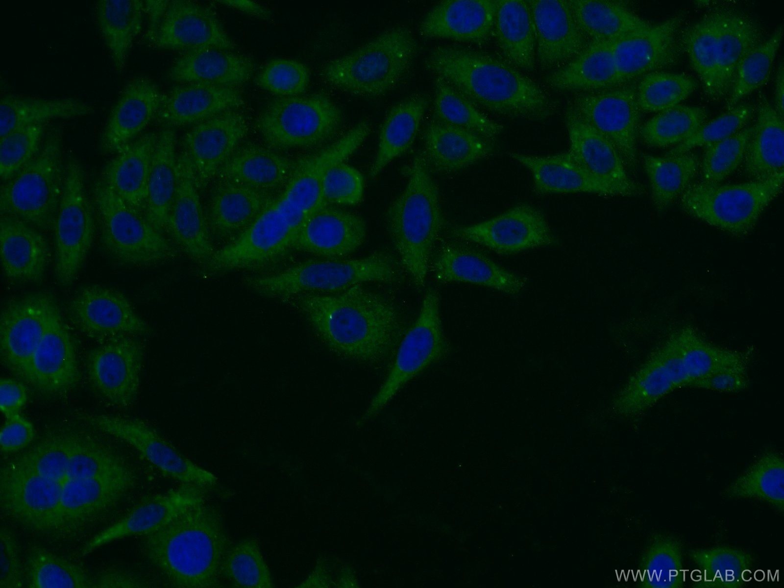 Pentraxin 3