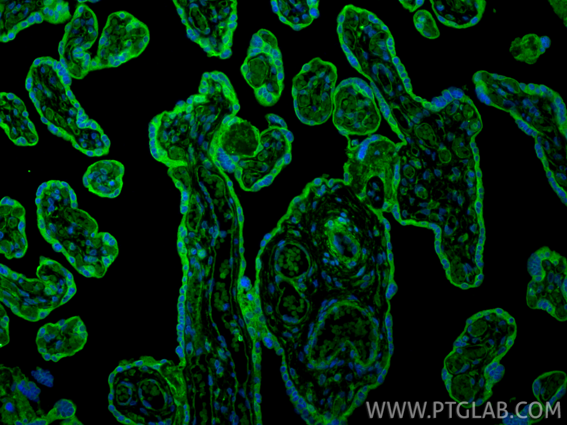 IF Staining of human placenta using 13797-1-AP