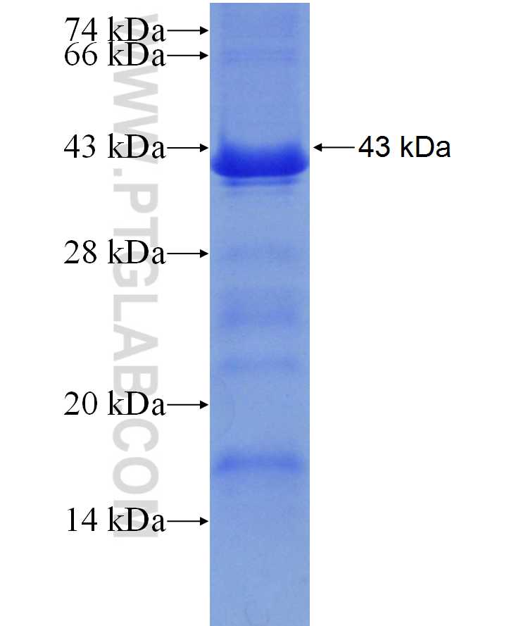 PTX3 fusion protein Ag29877 SDS-PAGE