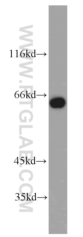 WB analysis of HeLa using 10810-1-AP