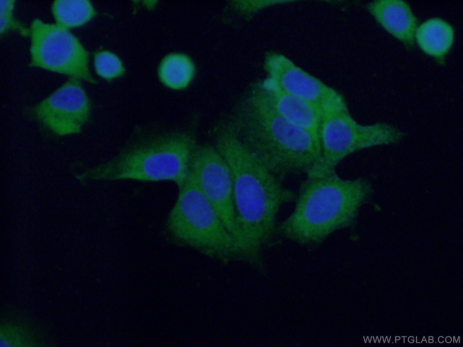 IF Staining of MCF-7 using 26256-1-AP