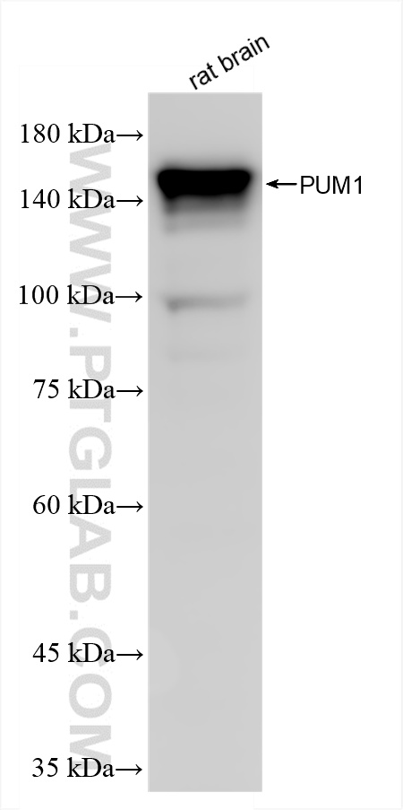 WB analysis of rat brain using 86129-1-RR (same clone as 86129-1-PBS)
