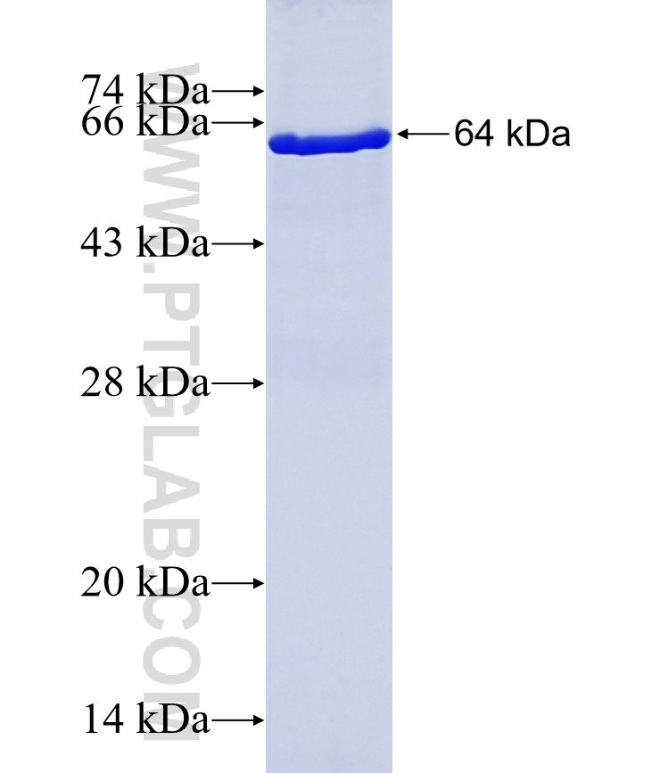 PUM2 fusion protein Ag2179 SDS-PAGE