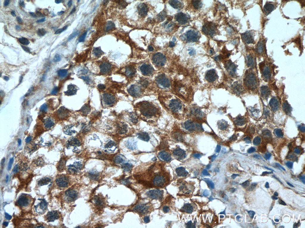 IHC staining of human testis using 55120-1-AP