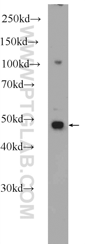 PURA Polyclonal antibody