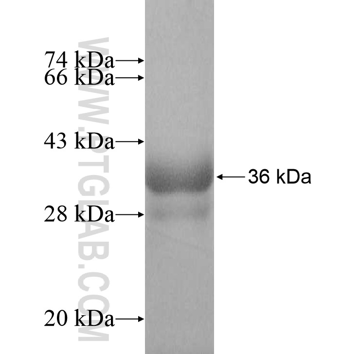 PUS7 fusion protein Ag8799 SDS-PAGE PUS7 fusion protein Ag8799 SDS-PAGE