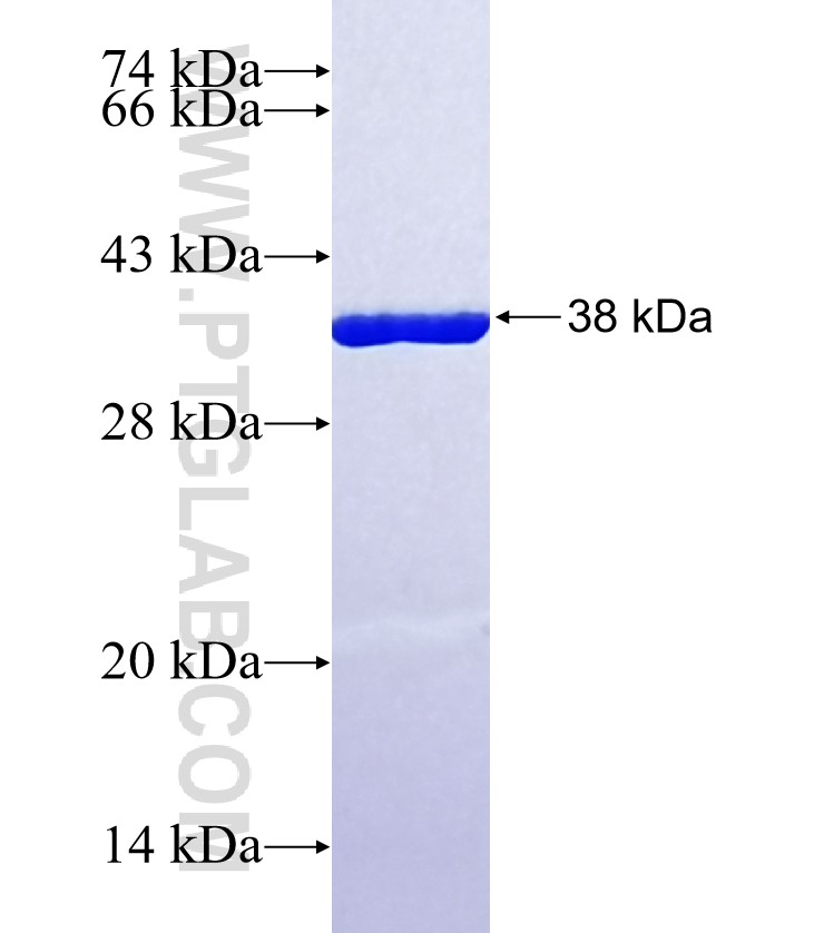 PVALB fusion protein Ag30189 SDS-PAGE