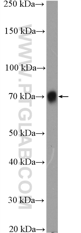 Poliovirus receptor