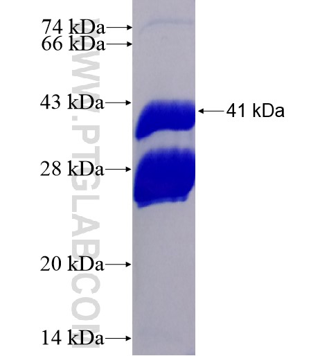 PVRIG fusion protein Ag13738 SDS-PAGE PVRIG fusion protein Ag13738 SDS-PAGE