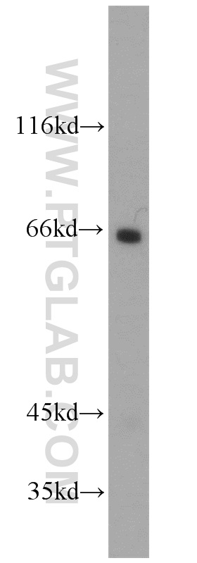 WB analysis of mouse kidney using 10100-2-AP