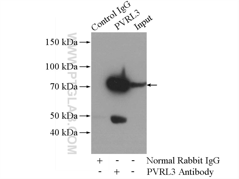 IP experiment of mouse testis using 11213-1-AP