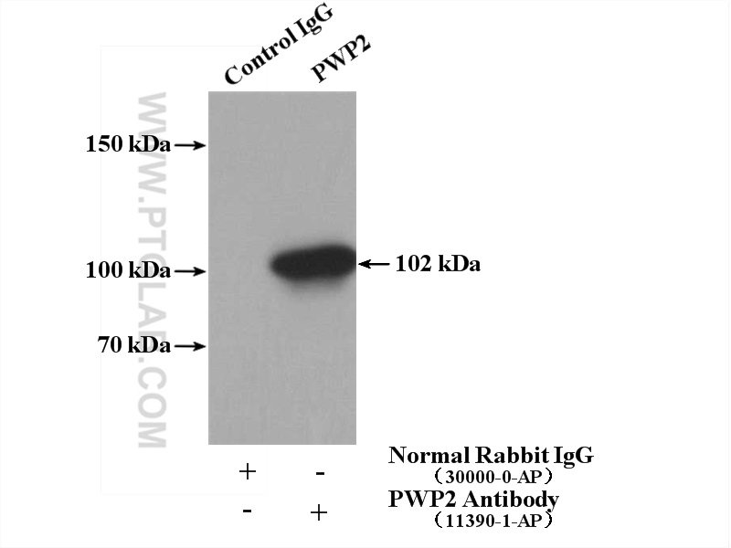 PWP2 Polyclonal antibody