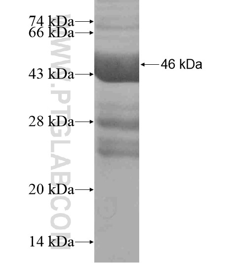 PXDN fusion protein Ag19155 SDS-PAGE PXDN fusion protein Ag19155 SDS-PAGE