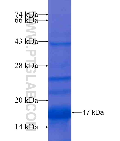 PXDNL fusion protein Ag19443 SDS-PAGE PXDNL fusion protein Ag19443 SDS-PAGE