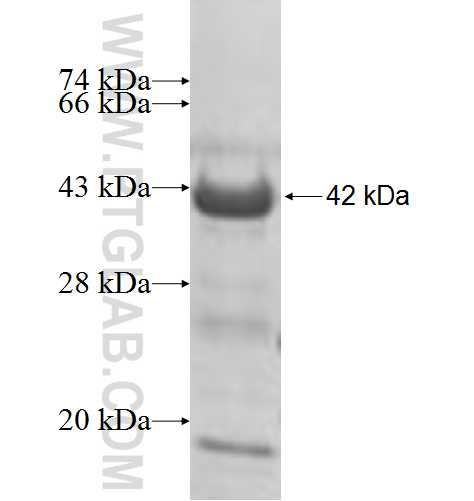 PXK fusion protein Ag9509 SDS-PAGE PXK fusion protein Ag9509 SDS-PAGE
