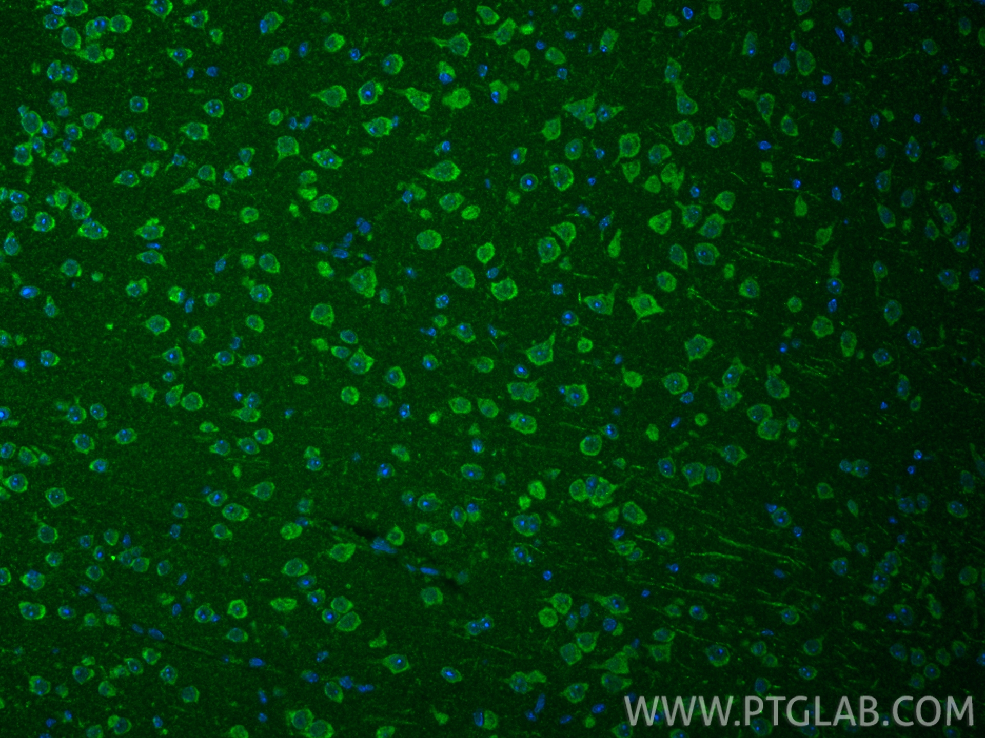 IF Staining of mouse brain using 24801-1-AP IF Staining of mouse brain using 24801-1-AP
