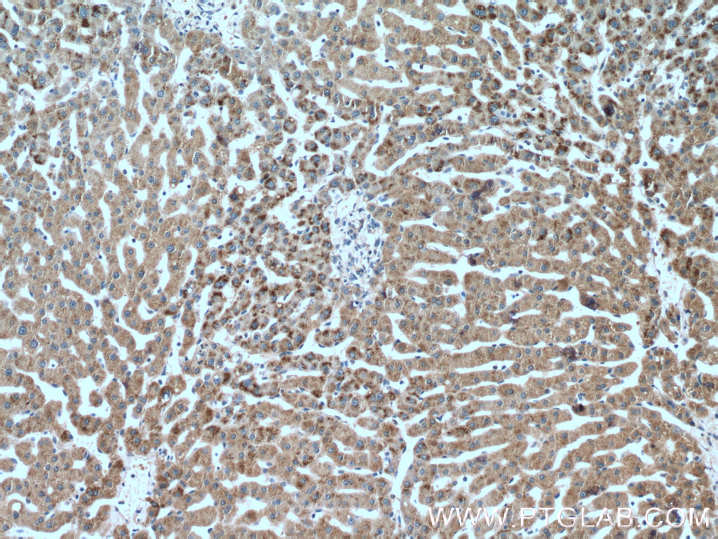 IHC staining of human liver using 22163-1-AP