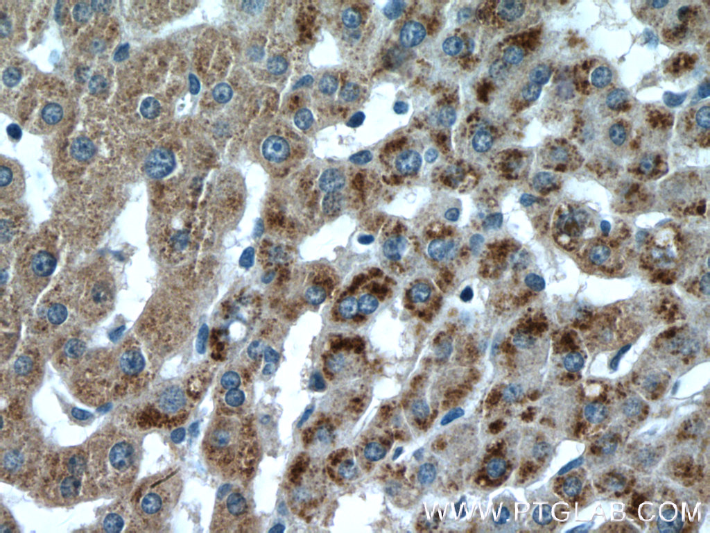 IHC staining of human liver using 22163-1-AP