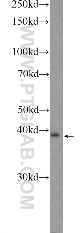 WB analysis of mouse liver using 22163-1-AP