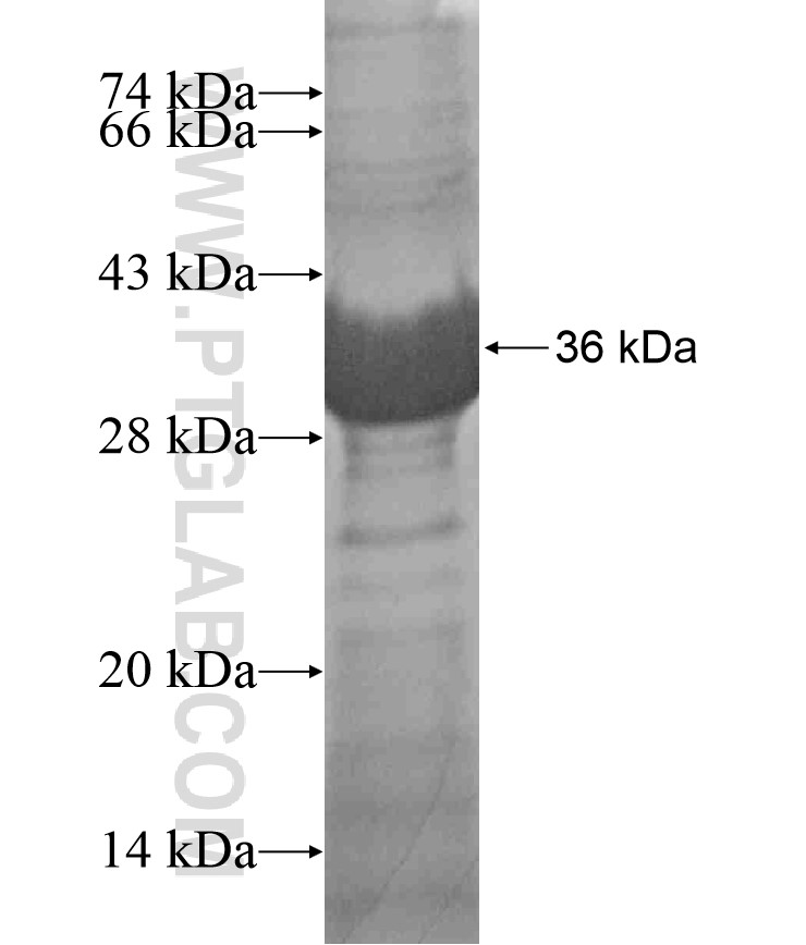 PXMP3 fusion protein Ag17898 SDS-PAGE PXMP3 fusion protein Ag17898 SDS-PAGE