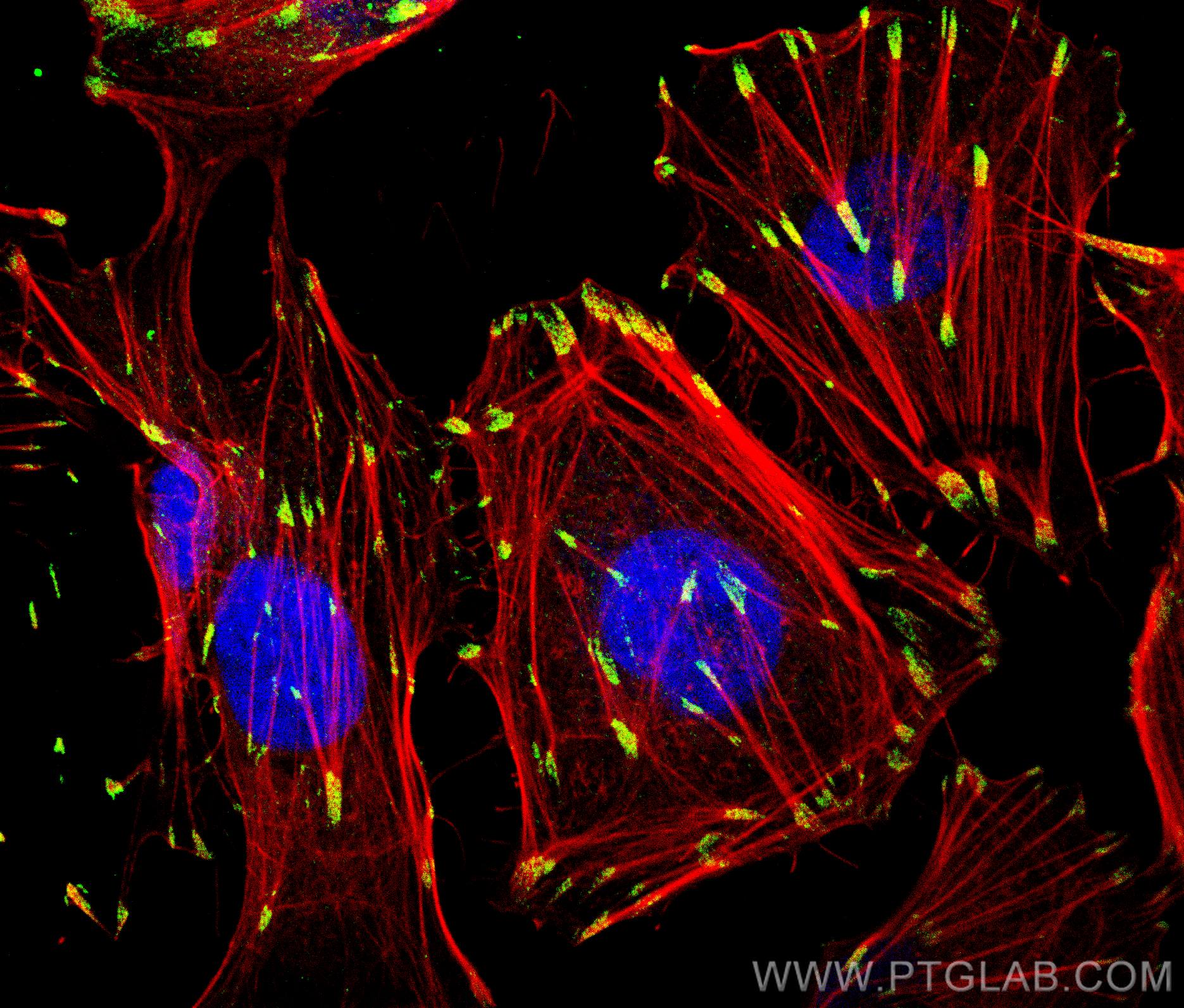 IF Staining of HUVEC using 10029-1-Ig