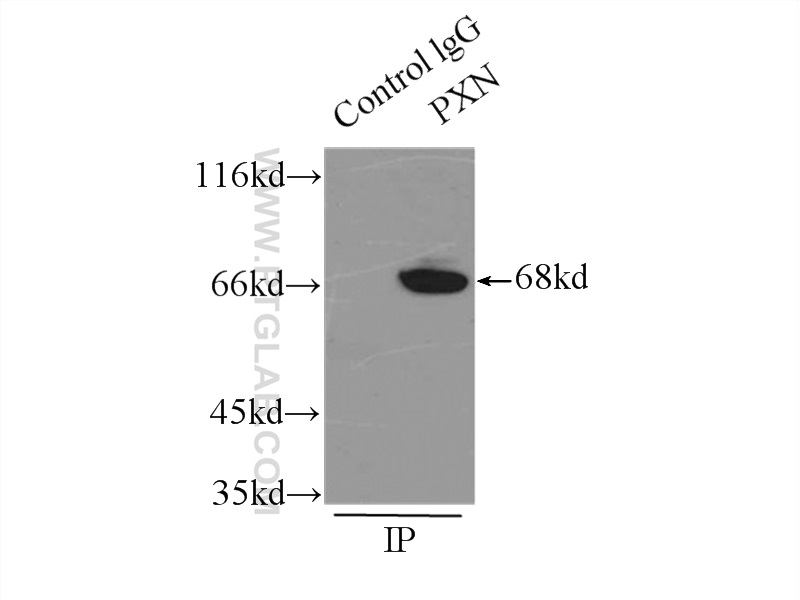 IP experiment of mouse brain using 10029-1-Ig