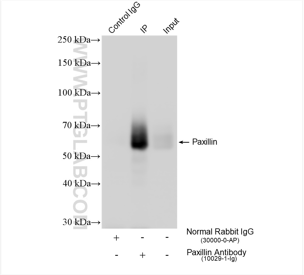 IP experiment of A431 using 10029-1-Ig