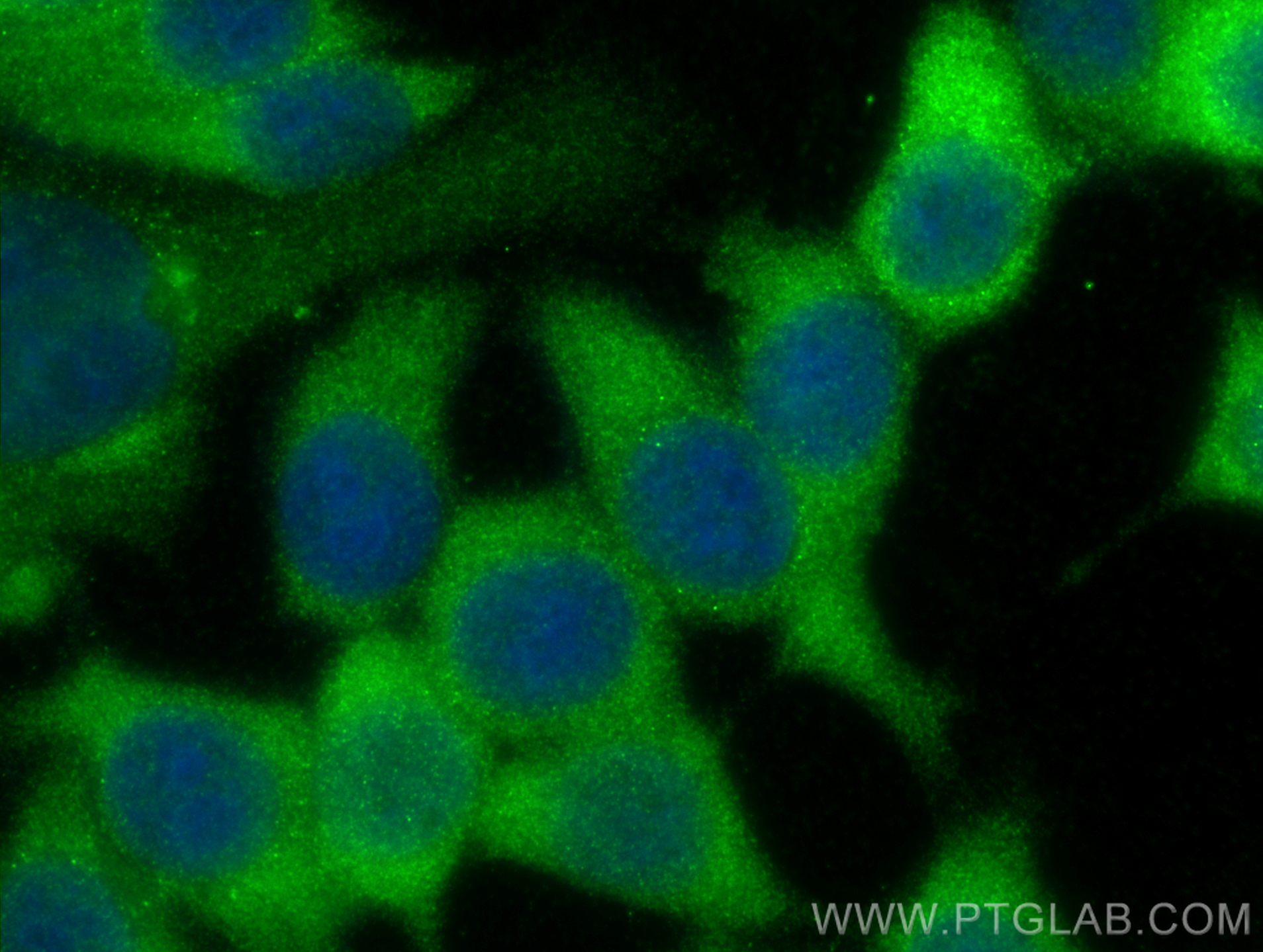 IF Staining of MCF-7 using 30641-1-AP