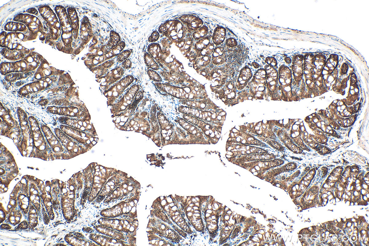 Immunohistochemical analysis of paraffin-embedded mouse colon tissue slide using 30641-1-AP (ASC/TMS1 antibody) at dilution of 1:400 (under 10x lens). Heat mediated antigen retrieval with Tris-EDTA buffer (pH 9.0). IHC staining of mouse colon using 30641-1-AP