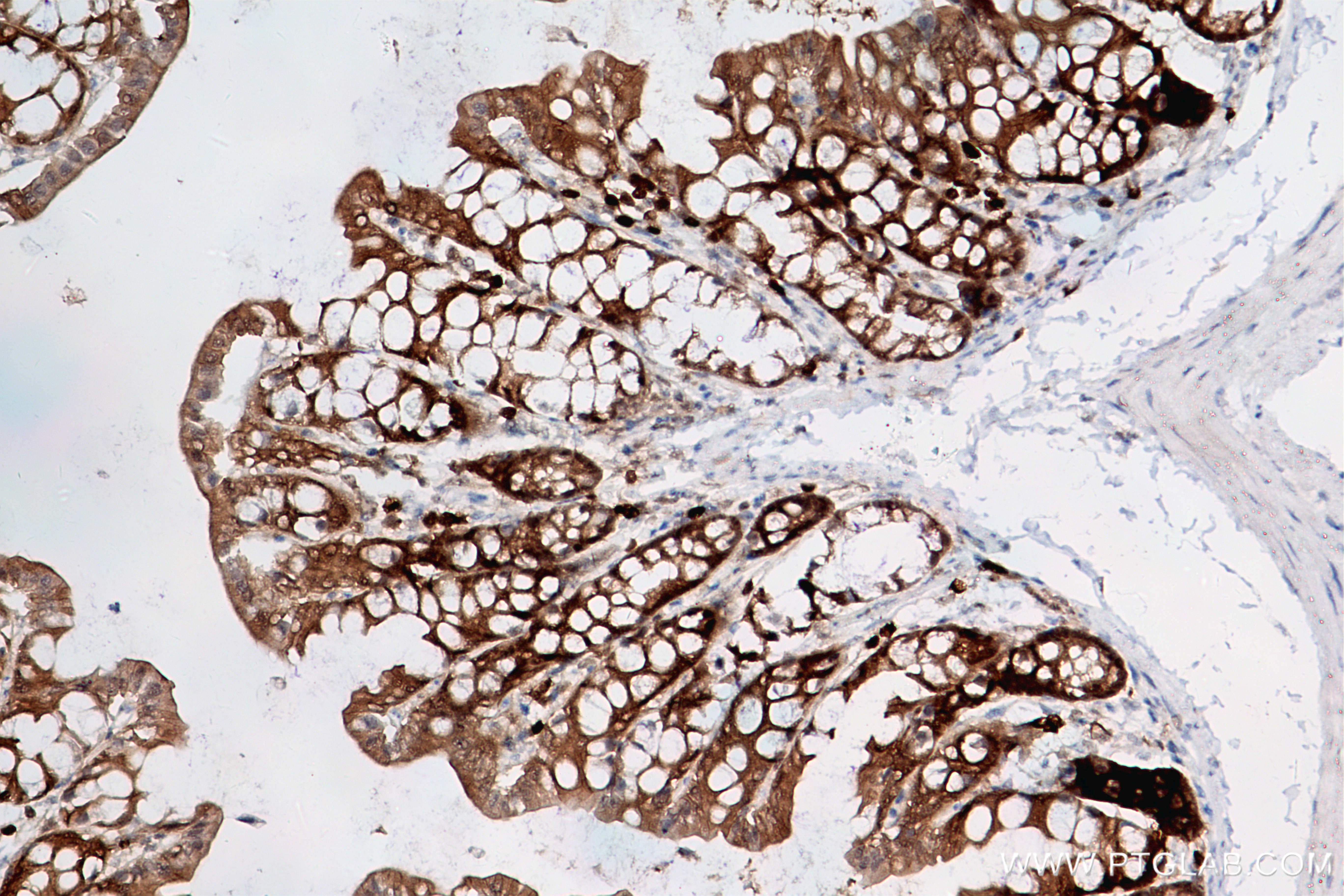 IHC staining of mouse colon using 83858-3-RR