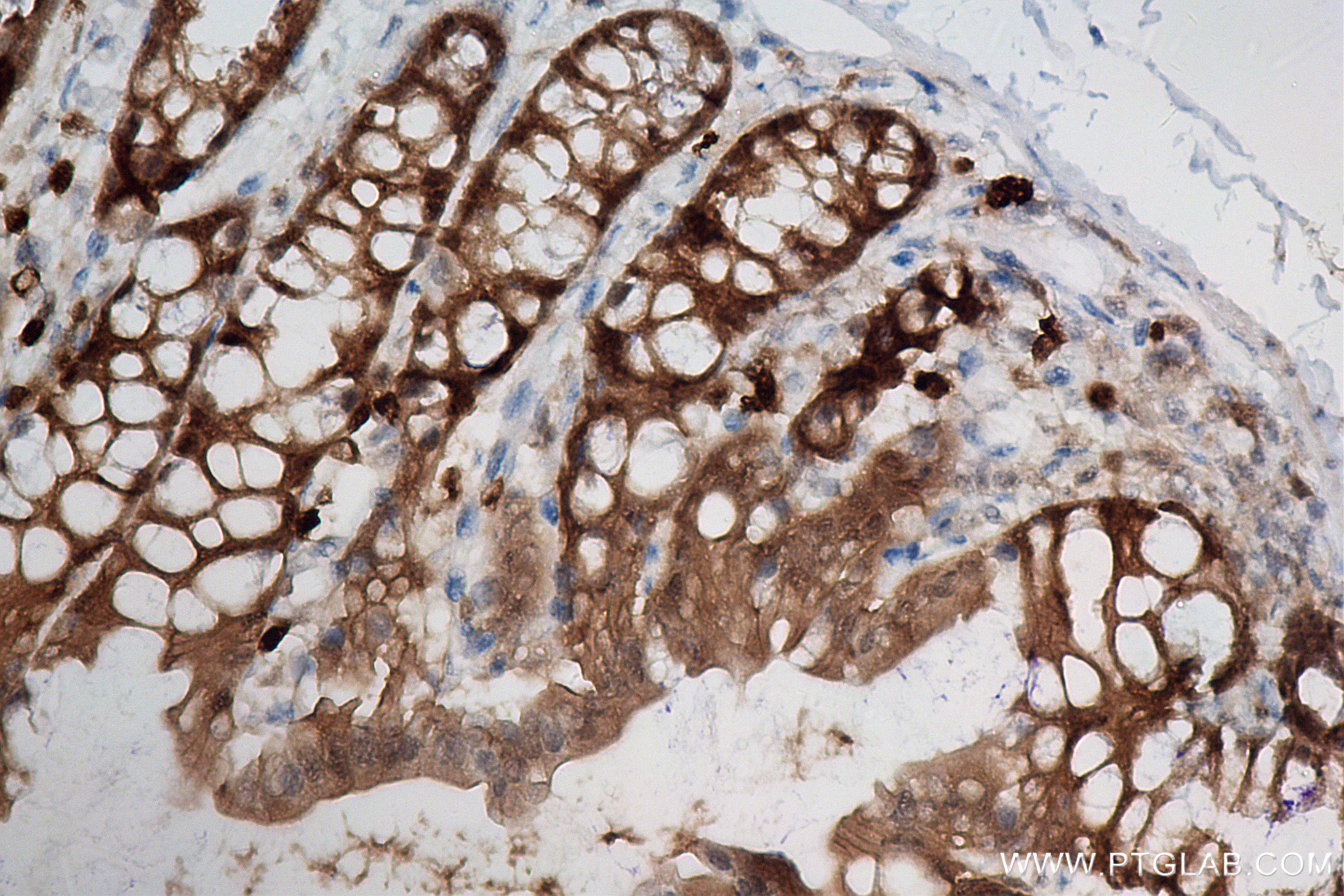 IHC staining of mouse colon using 83858-3-RR