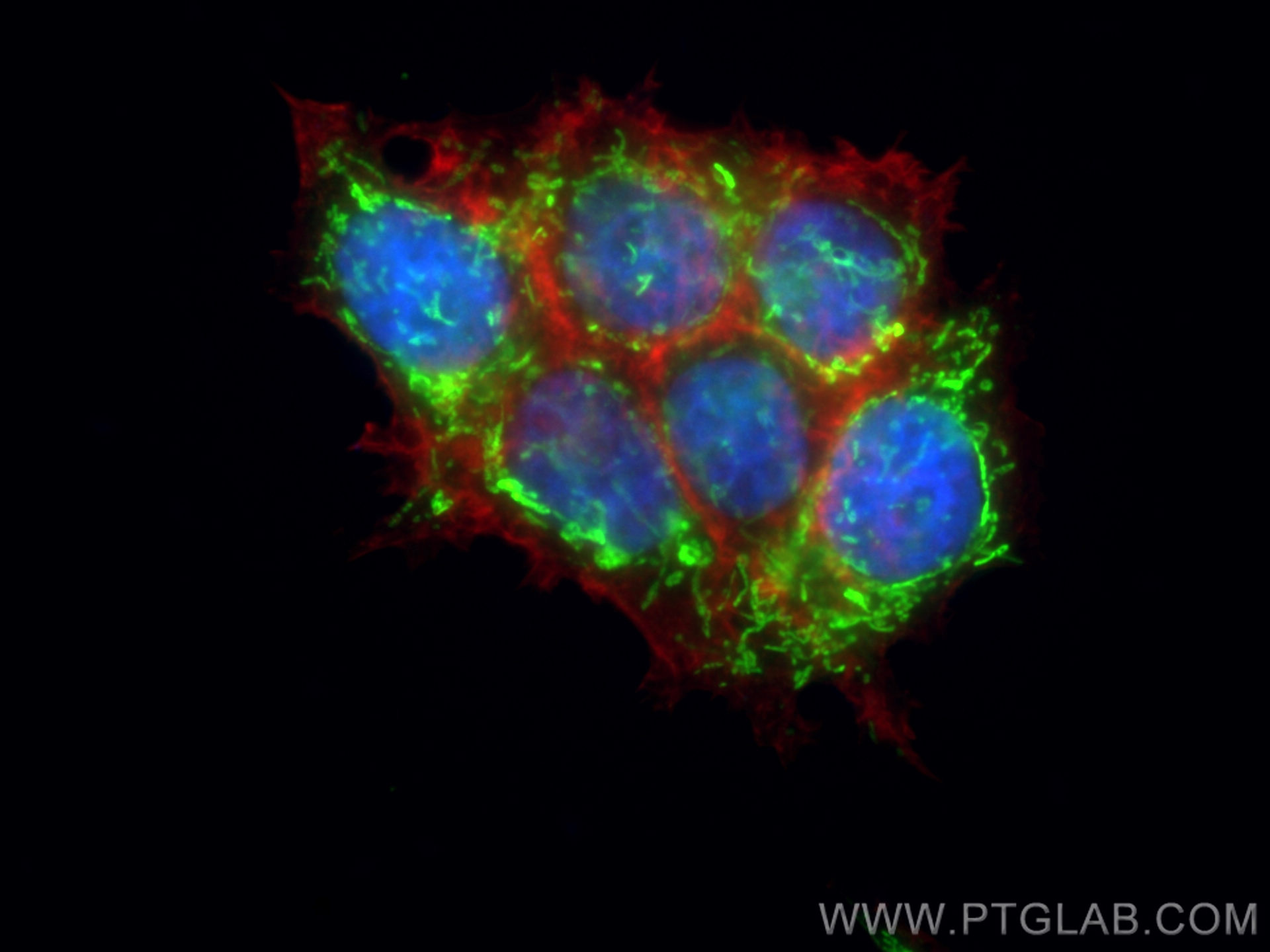 IF Staining of MCF-7 using 13108-1-AP