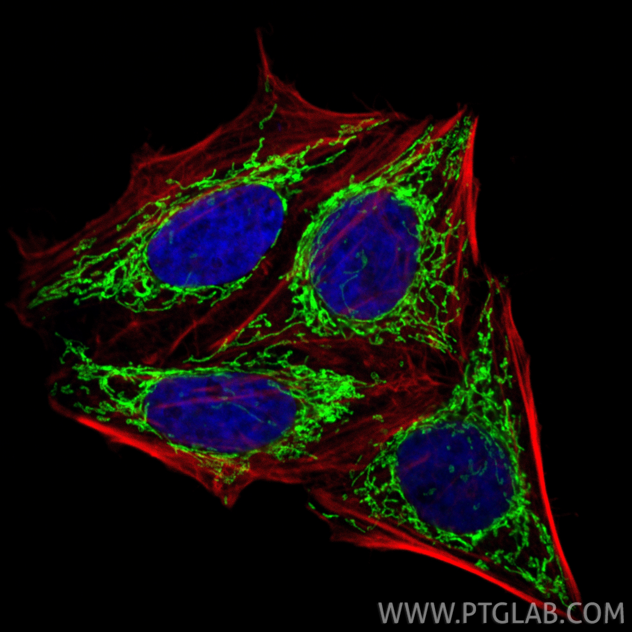 IF Staining of HepG2 using 13108-1-AP IF Staining of HepG2 using 13108-1-AP