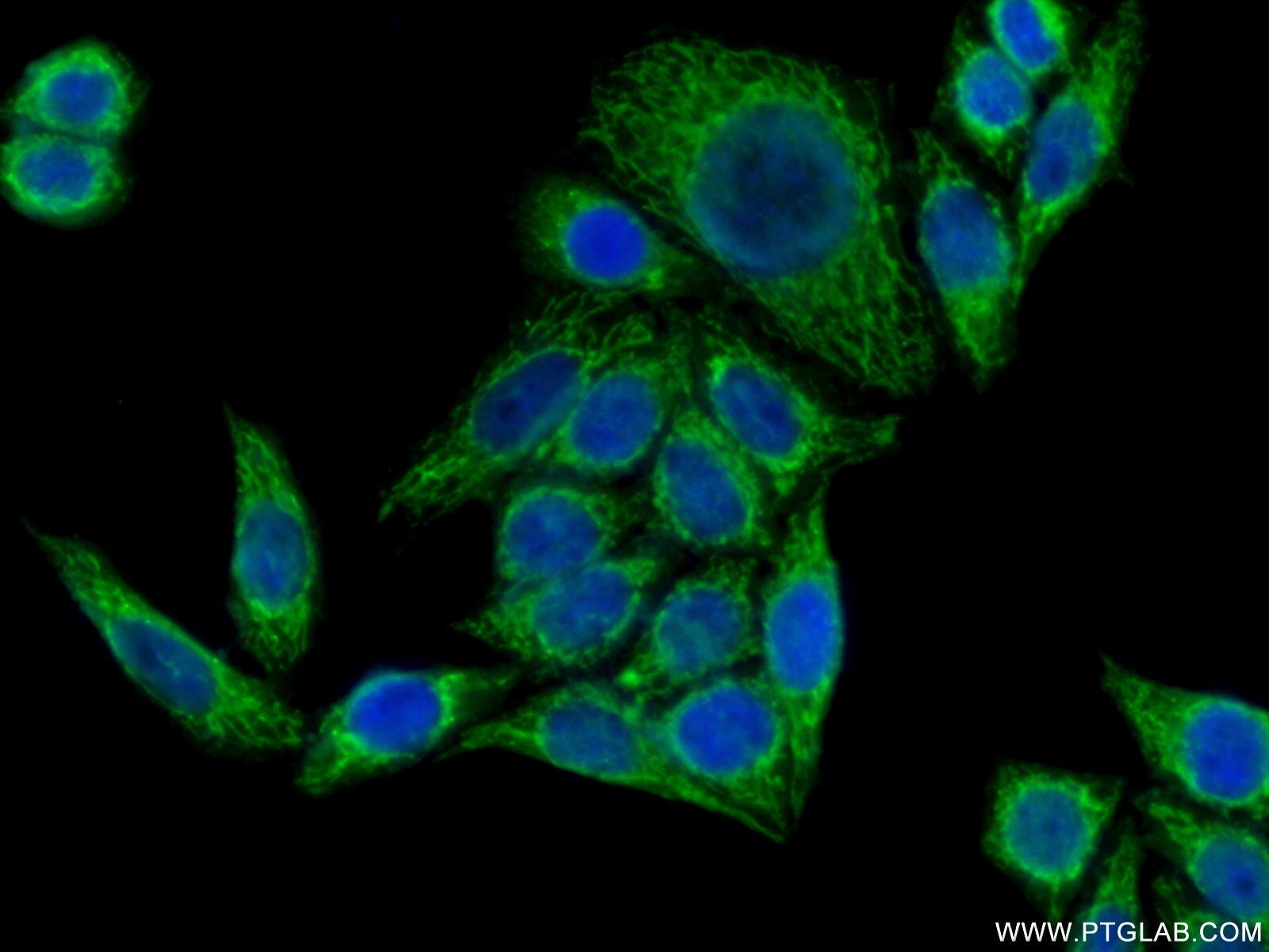 IF Staining of HeLa using 22150-1-AP (same clone as 22150-1-PBS)