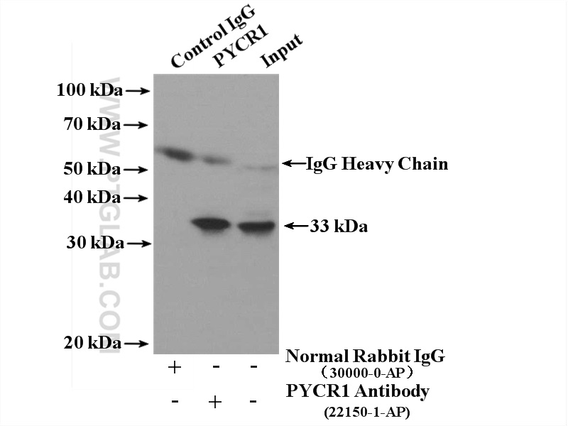 IP experiment of HeLa using 22150-1-AP (same clone as 22150-1-PBS)