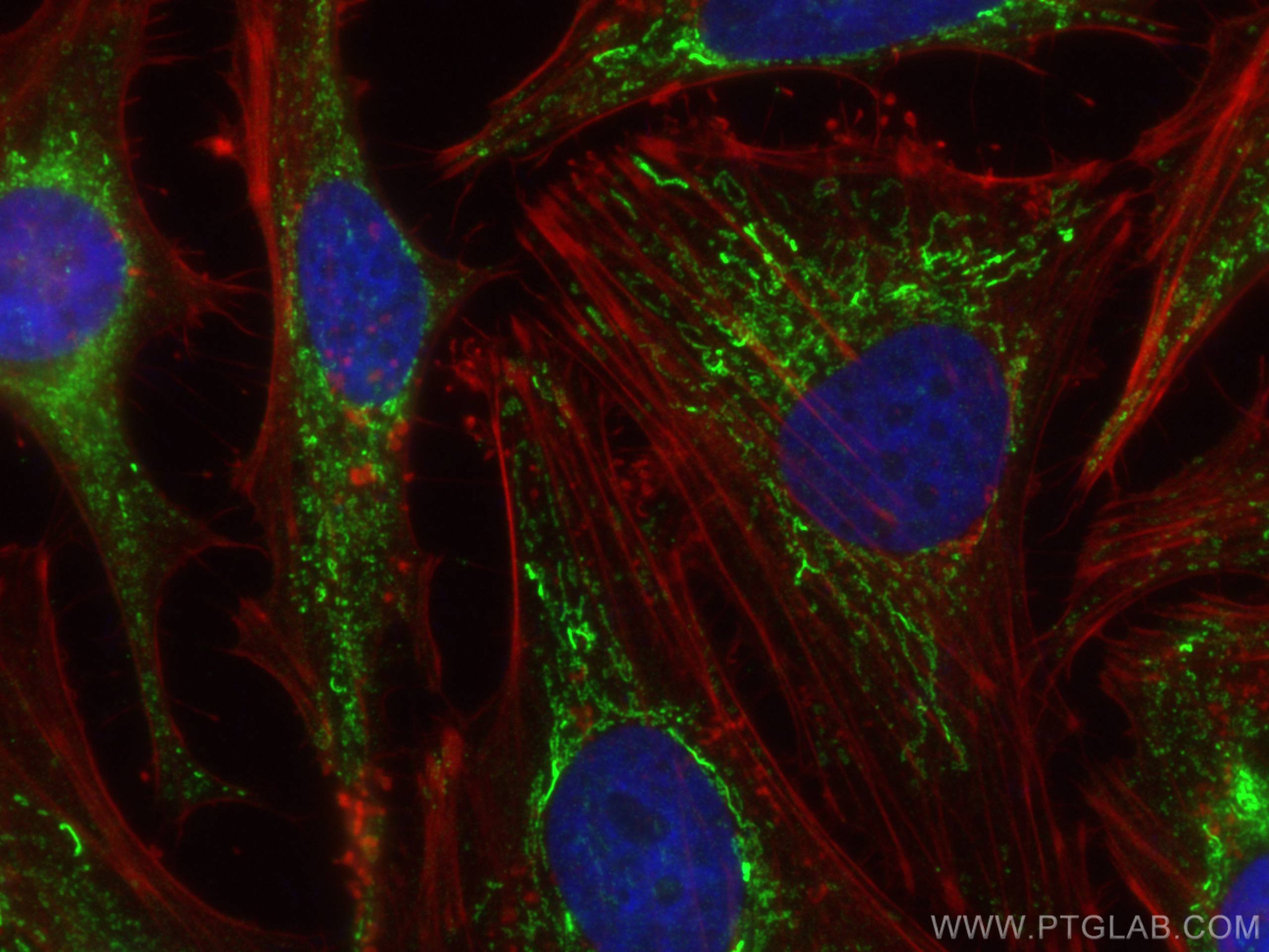 IF Staining of HeLa using 66510-1-Ig (same clone as 66510-1-PBS)