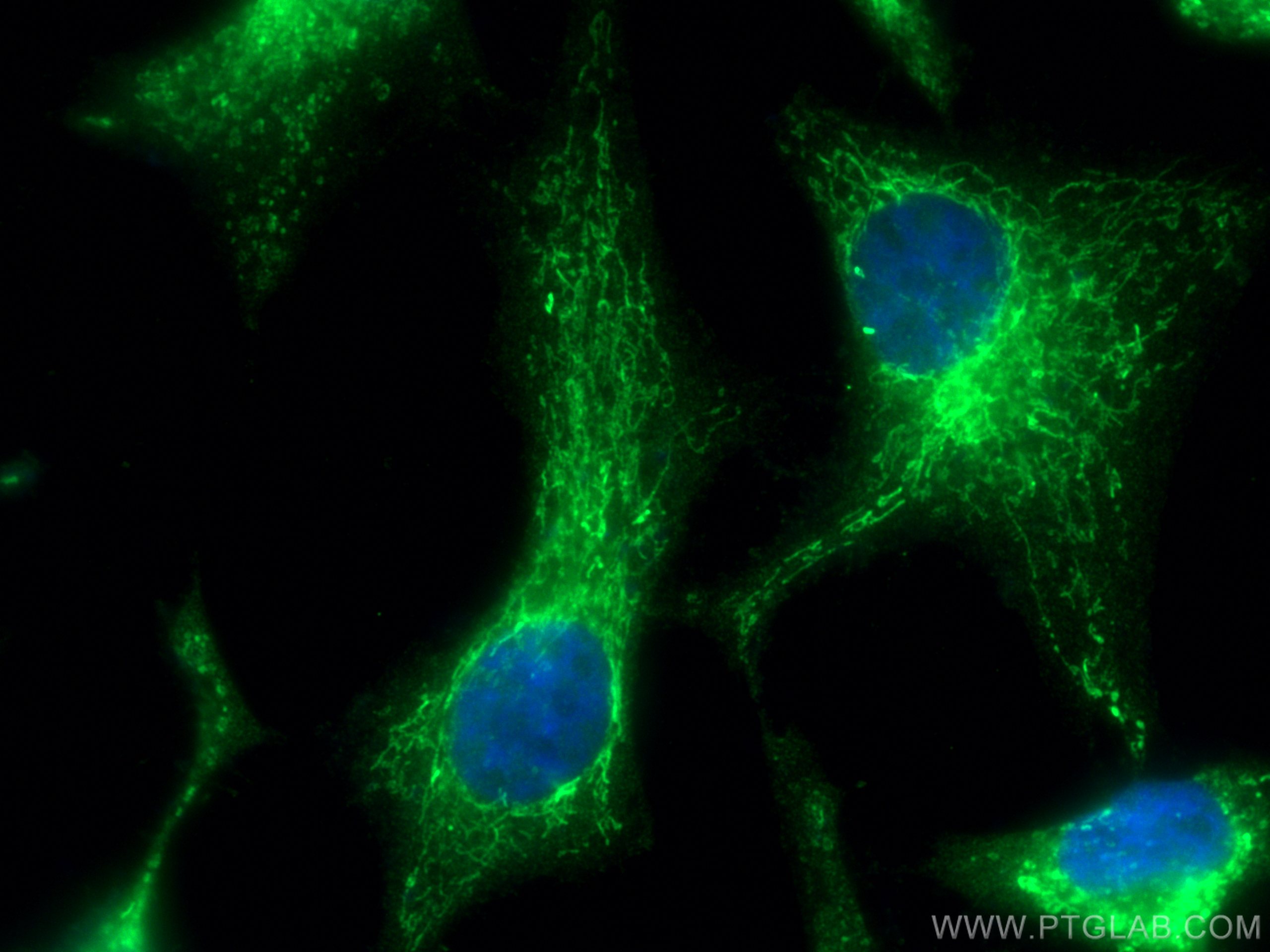 IF Staining of HeLa using 17146-1-AP