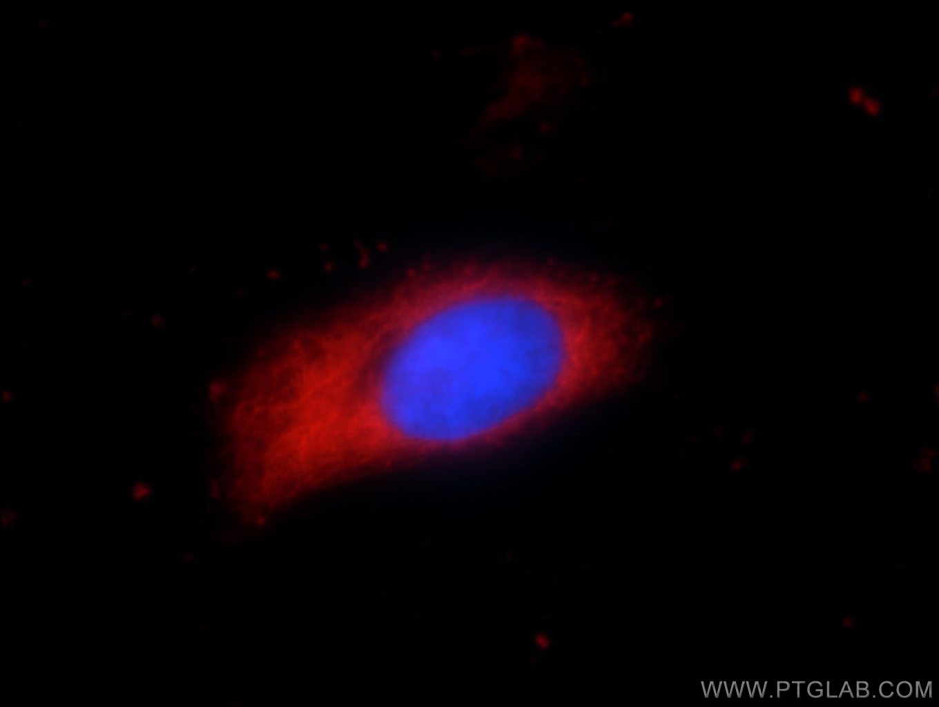 IF Staining of HeLa using 55060-1-AP