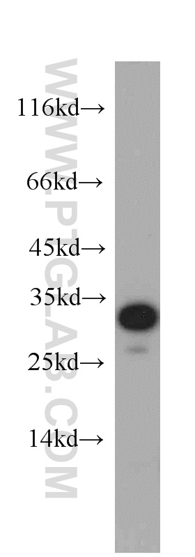 WB analysis of HeLa using 55060-1-AP