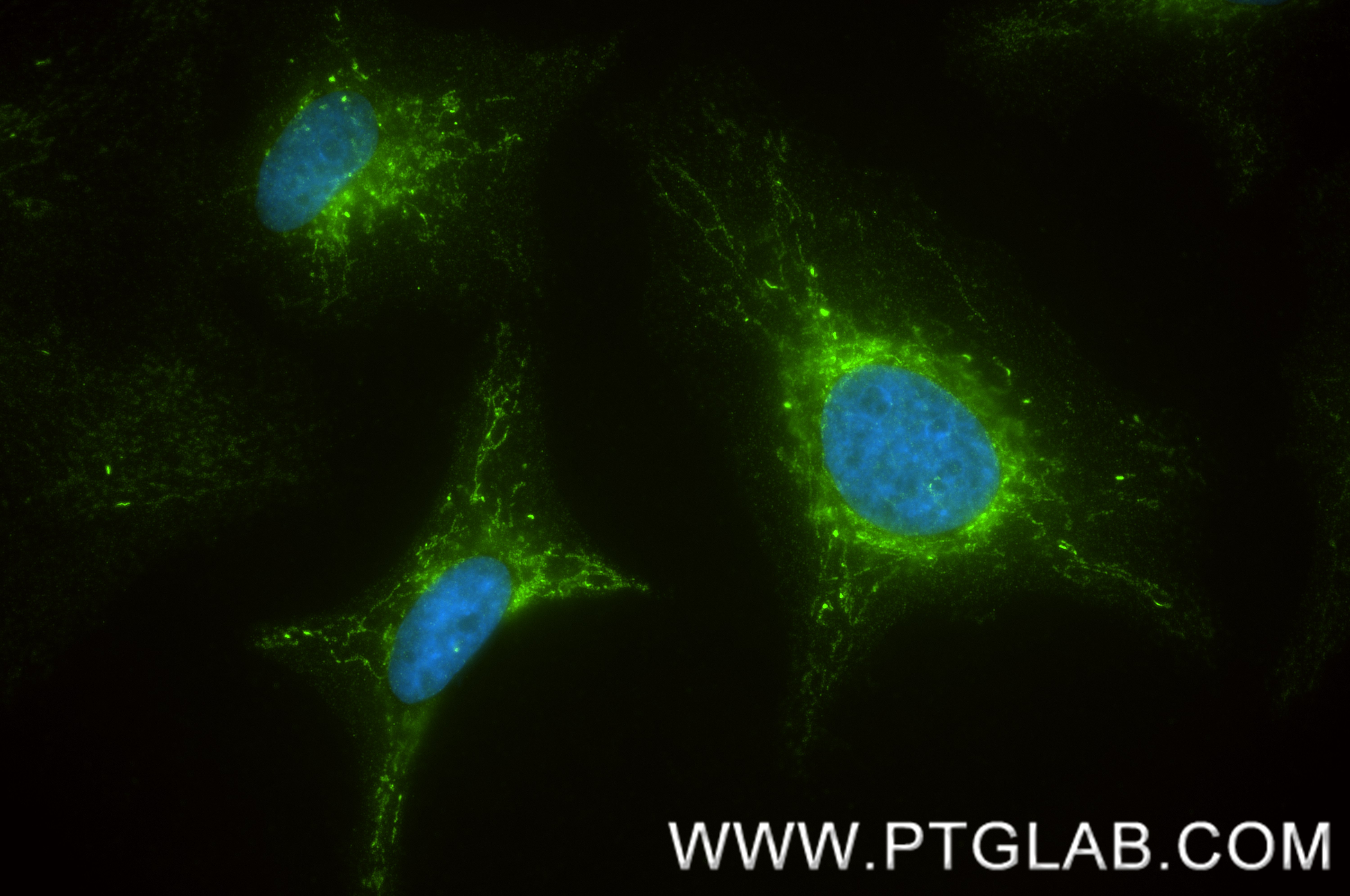 IF Staining of HeLa using 87985-2-RR (same clone as 87985-2-PBS)